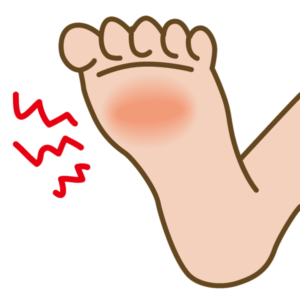 足底筋膜炎について
