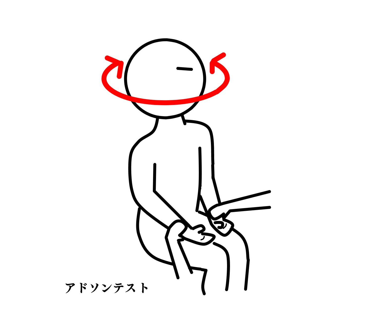 アドソンテストの解説
