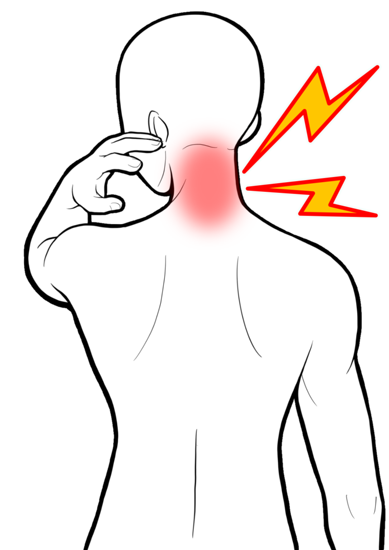 頚椎椎間板ヘルニアについて